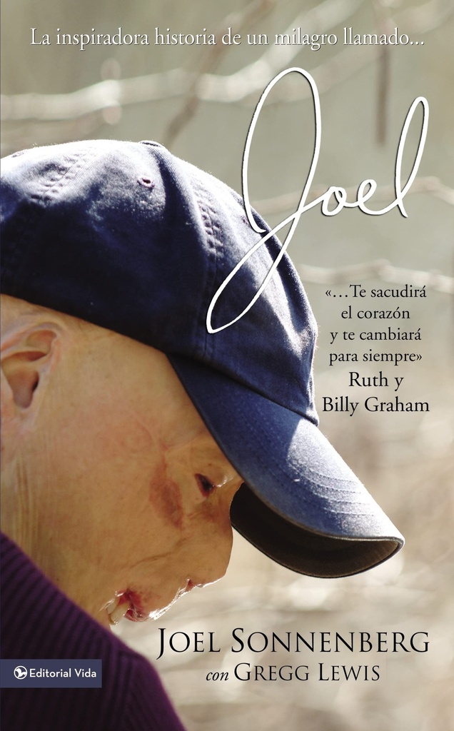 [HCV4595] Joel